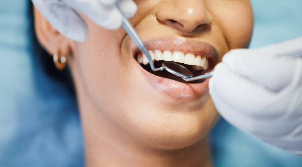 Best Broken Tooth Emergency  in Spring Lake, NC